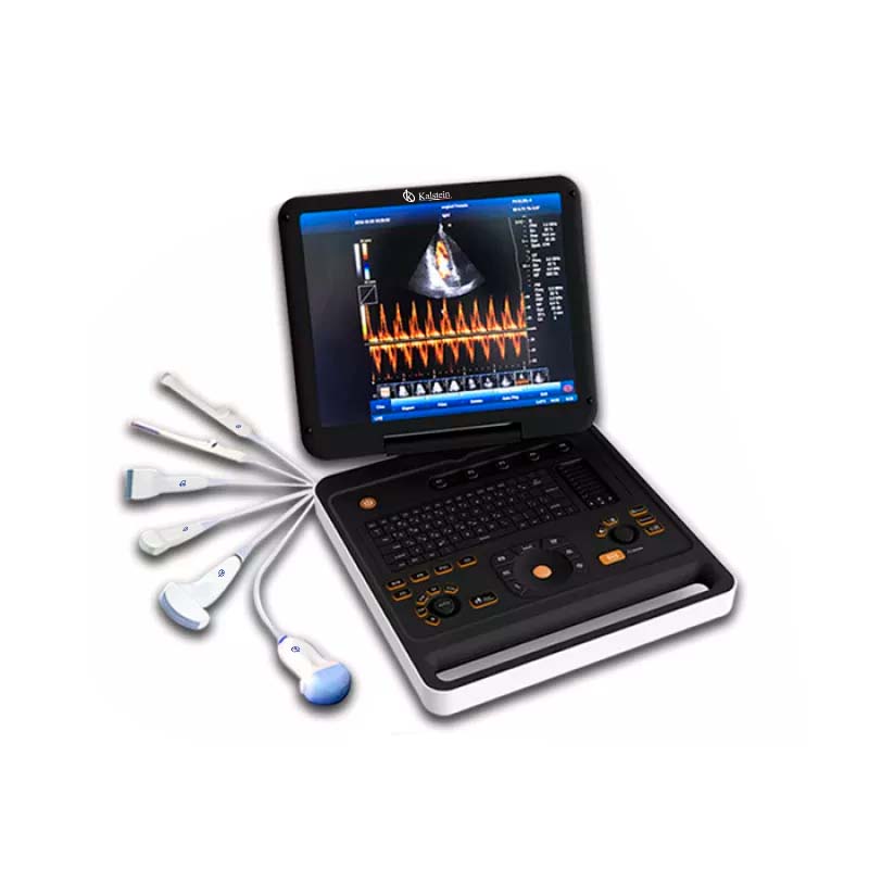 Ultrasound scan: characteristics and types